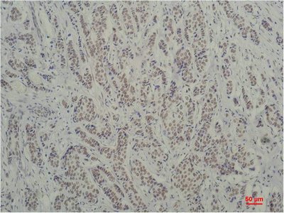 Mouse anti-Human/Mouse/Rat TBP Monoclonal Antibody