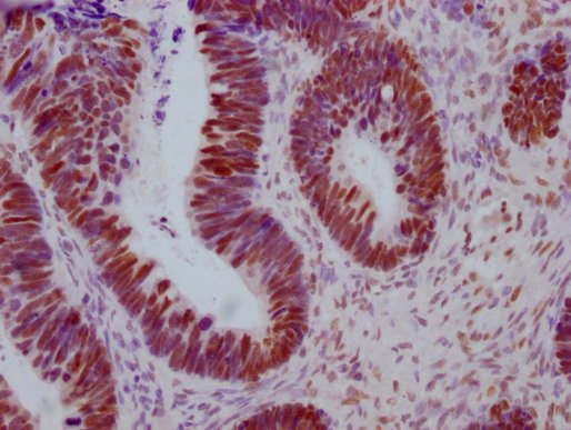 Mouse anti-Human sapiens (Human) ESR1 Monoclonal Antibody