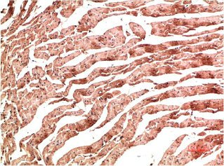 Mouse anti-Human/Mouse/Rat CDH5 Monoclonal Antibody