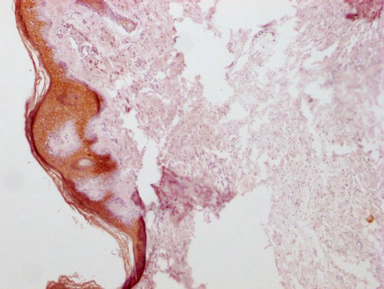 Mouse anti-Human sapiens (Human) KRT1 Monoclonal Antibody