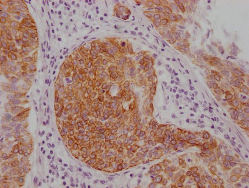 Mouse anti-Human sapiens (Human) KRT14 Monoclonal Antibody
