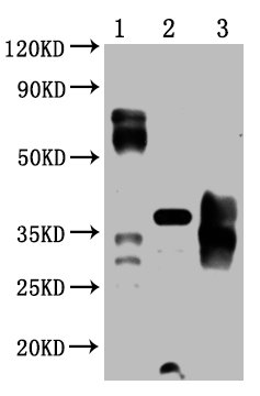 Mouse anti-Human sapiens (Human) PDCD1 Monoclonal Antibody