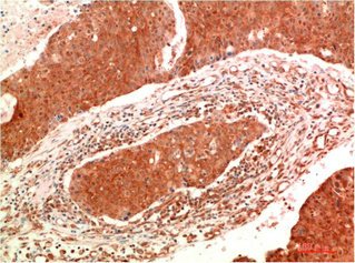 Mouse anti-Human/Mouse/Rat JAK2 Monoclonal Antibody