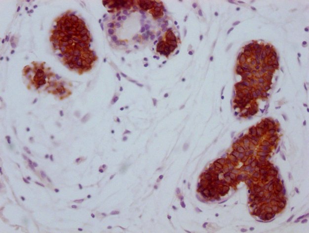 Mouse anti-Human sapiens (Human) KRT15 Monoclonal Antibody