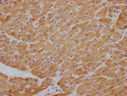 Mouse anti-Human ACTB/POTEKP/ACTG1 Monoclonal Antibody