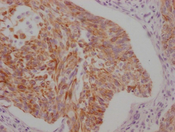 Mouse anti-Human KRT5/KRT6A Monoclonal Antibody