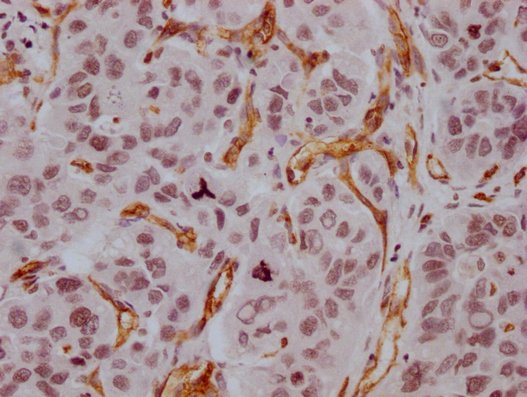 Mouse anti-Human sapiens (Human) CD34 Monoclonal Antibody