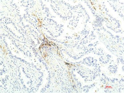 Mouse anti-Human/Mouse/Rat JAK1 Monoclonal Antibody