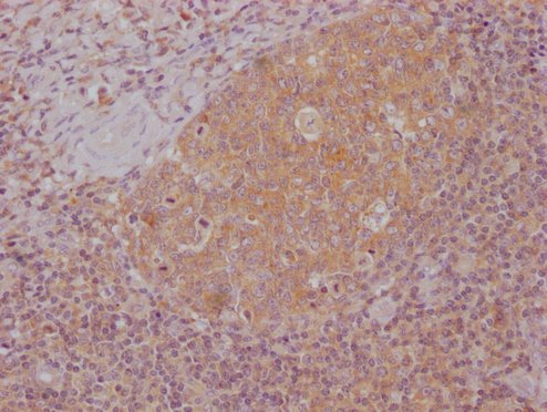 Mouse anti-Human sapiens (Human) MS4A1 Monoclonal Antibody
