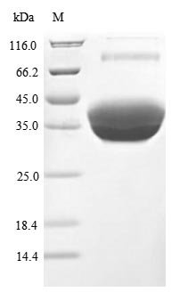 Recombinant Human Tumor necrosis factor receptor superfamily member 17 (TNFRSF17), partial (Active), Homo sapiens (Human), Mammalian cell, C-terminal hFc1-tagged, 34.8 kDa, purity >90% as determined by SDS-PAGE.