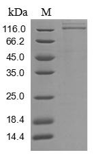 Recombinant Human Vascular endothelial growth factor receptor 1 (FLT1), partial (Active), Homo sapiens (Human), Mammalian cell, C-terminal 6xHis-tagged, 82.2 kDa, purity >90% as determined by SDS-PAGE.