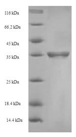 Recombinant Human C-type lectin domain family 4 member C (CLEC4C), partial (Active), Homo sapiens (Human), E.coli, N-terminal 6xHis-SUMO-tagged, 36.0 kDa, purity >90% as determined by SDS-PAGE.
