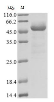 Recombinant Severe acute respiratory syndrome coronavirus 2 Nucleoprotein (N) (Active), Severe acute respiratory syndrome coronavirus 2 (2019-nCoV) (SARS-CoV-2), E.coli, N-terminal 6xHis-tagged, 49.7 kDa, purity >85% as determined by SDS-PAGE.