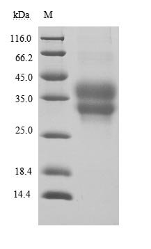 Recombinant Human Programmed cell death protein 1 (PDCD1), partial (Active), Homo sapiens (Human), Mammalian cell, C-terminal 6xHis-tagged, 18.2 kDa, purity >95% as determined by SDS-PAGE.Greater than 95% as determined by SEC-HPLC.
