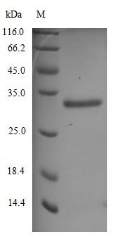 Recombinant Severe acute respiratory syndrome coronavirus 2 Spike glycoprotein (S) (N501Y), partial (Active), Severe acute respiratory syndrome coronavirus 2 (2019-nCoV) (SARS-CoV-2), Mammalian cell, C-terminal 10xHis-tagged, 27.9 kDa, purity >90% as determined by SDS-PAGE.