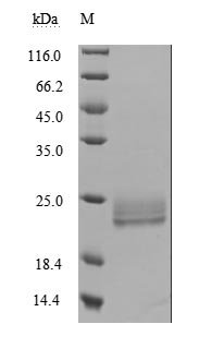 Recombinant Human Lymphotoxin-alpha (LTA) (Active), Homo sapiens (Human), Mammalian cell, N-terminal 6xHis-tagged, 20.8 kDa, purity >95% as determined by SDS-PAGE.
