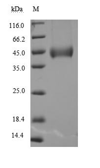 Recombinant Human Pro-neuregulin-1, membrane-bound isoform (NRG1), partial (Active), Homo sapiens (Human), Mammalian cell, C-terminal 6xHis-tagged, 27.1 kDa, purity >95% as determined by SDS-PAGE.Greater than 95% as determined by SEC-HPLC.
