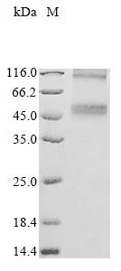 Recombinant Human Cystine/glutamate transporter (SLC7A11) (Active), Homo sapiens (Human), in vitro E.coli expression system, N-terminal 10xHis-tagged, 58.2 kDa, purity >90% as determined by SDS-PAGE.