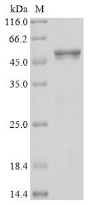 Recombinant Severe acute respiratory syndrome coronavirus 2 Nucleoprotein (N) (P80R) (Active), Severe acute respiratory syndrome coronavirus 2 (2019-nCoV) (SARS-CoV-2), E.coli, N-terminal 6xHis-tagged, 49.8 kDa, purity >96% as determined by SDS-PAGE.