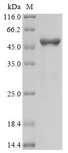 Recombinant Severe acute respiratory syndrome coronavirus 2 Nucleoprotein (N) (T205I) (Active), Severe acute respiratory syndrome coronavirus 2 (2019-nCoV) (SARS-CoV-2), E.coli, N-terminal 6xHis-tagged, 49.7 kDa, purity >93% as determined by SDS-PAGE.