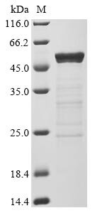 Recombinant Severe acute respiratory syndrome coronavirus 2 Nucleoprotein (N) (I292T) (Active), Severe acute respiratory syndrome coronavirus 2 (2019-nCoV) (SARS-CoV-2), E.coli, N-terminal 6xHis-tagged, 49.7 kDa, purity >83% as determined by SDS-PAGE.
