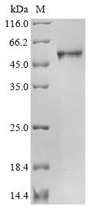 Recombinant Severe acute respiratory syndrome coronavirus 2 Nucleoprotein (N) (R203K,G204R) (Active), Severe acute respiratory syndrome coronavirus 2 (2019-nCoV) (SARS-CoV-2), E.coli, N-terminal 6xHis-tagged, 49.8 kDa, purity >96% as determined by SDS-PAGE.