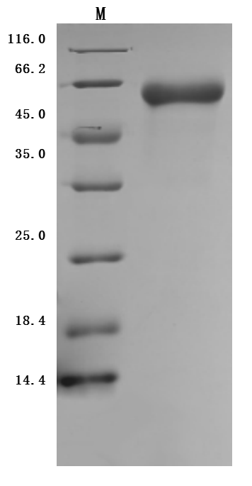 Recombinant Human Inactive tyrosine-protein kinase transmembrane receptor ROR1 (ROR1), partial (Active), Homo sapiens (Human), Mammalian cell, C-terminal 10xHis-tagged, 44.8 kDa, purity >95% as determined by SDS-PAGE.Greater than 90% as determined by SEC-HPLC.