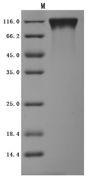 Recombinant Human Tyrosine-protein kinase Mer (MERTK), partial (Active), Homo sapiens (Human), Mammalian cell, C-terminal 10xHis-tagged, 55.4 kDa, purity >95% as determined by SDS-PAGE.Greater than 95% as determined by SEC-HPLC.