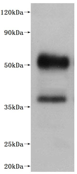 Recombinant Human C5a anaphylatoxin chemotactic receptor 1 (C5AR1)-VLPs (Active), Homo sapiens (Human), Mammalian cell, C-terminal 10xHis-tagged (This tag can be tested only under denaturing conditions), 41.1 kDa
