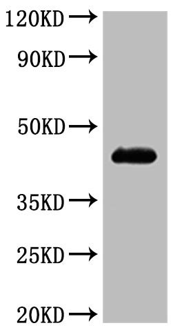 Recombinant Human C-C chemokine receptor type 4 (CCR4)-VLPs (Active), Homo sapiens (Human), Mammalian cell, C-terminal 10xHis-tagged (This tag can be tested only under denaturing conditions), 43.2 kDa