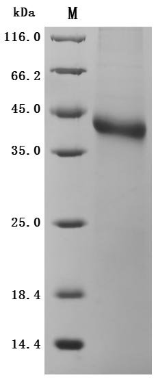 Recombinant Human R-spondin-1 (RSPO1), partial (Active), Homo sapiens (Human), Mammalian cell, C-terminal 10xHis-Avi-tagged, 30.2 kDa, purity >95% as determined by SDS-PAGE.