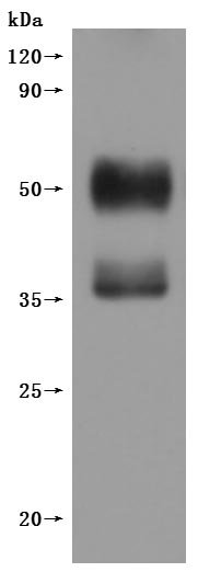 Recombinant Human C-X-C chemokine receptor type 4 (CXCR4)-VLPs (Active), Homo sapiens (Human), Mammalian cell, C-terminal 10xHis-tagged (This tag can be tested only under denaturing conditions), 41.5 kDa