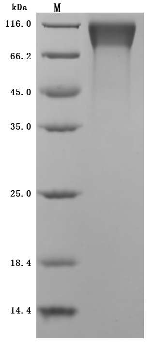 Recombinant Mouse Tyrosine-protein kinase Mer (Mertk), partial (Active), Mus musculus (Mouse), Mammalian cell, C-terminal 10xHis-tagged, 55.0 kDa, purity >95% as determined by SDS-PAGE.