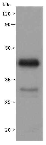 Recombinant Dog B-lymphocyte antigen CD20 (MS4A1)-VLPs (Active), Canis lupus familiaris (Dog) (Canis familiaris), Mammalian cell, C-terminal 10xHis-tagged (This tag can be tested only under denaturing conditions), 34.4 kDa, purity >90% as determined by SEC-HPLC.