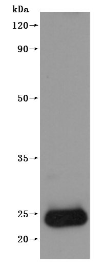 Recombinant Human Claudin-4 (CLDN4)-VLPs (Active), Homo sapiens (Human), Mammalian cell, C-terminal 10xHis-tagged (This tag can be tested only under denaturing conditions), 23.4 kDa