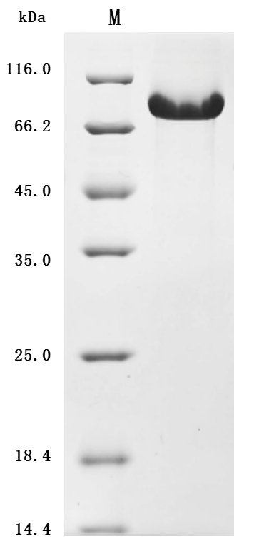Recombinant Human Complement component C1q receptor (CD93), partial (Active), Homo sapiens (Human), Mammalian cell, C-terminal 10xHis-tagged, 60.1 kDa, purity >90% as determined by SDS-PAGE.Greater than 90% as determined by SEC-HPLC.