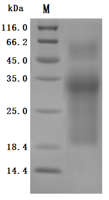 Recombinant Human Mucin-17 (MUC17), partial (Active), Homo sapiens (Human), Mammalian cell, C-terminal 10xHis-tagged, 32.0kDa, purity >95% as determined by SDS-PAGE.