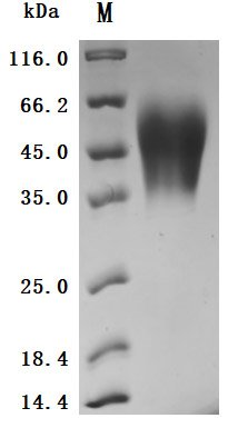 Recombinant Human Carcinoembryonic antigen-related cell adhesion molecule 6 (CEACAM6) (Active), Homo sapiens (Human), Mammalian cell, C-terminal 10xHis-tagged, 32.6 kDa, purity >95% as determined by SDS-PAGE.
