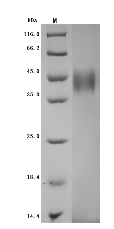 Recombinant Human Tumor-associated calcium signal transducer 2 (TACSTD2), partial (Active), Homo sapiens (Human), Mammalian cell, C-terminal 10xHis-tagged, 30.6 kDa, purity >95% as determined by SDS-PAGE.