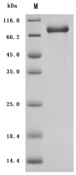 Recombinant Human Interleukin-12 receptor subunit beta-1(IL12RB1),partial (Active), Homo sapiens (Human), Mammalian cell, C-terminal 10xHis-tagged, 58.5 kDa, purity >95% as determined by SDS-PAGE.Greater than 95% as determined by SEC-HPLC.