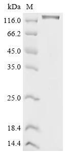 Recombinant Human Vascular endothelial growth factor receptor 2 (KDR), partial (Active), Homo sapiens (Human), Mammalian cell, C-terminal hFc1-tagged, 112.2 kDa, purity >95% as determined by SDS-PAGE.Greater than 90% as determined by SEC-HPLC.