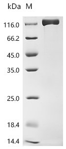 Recombinant Human Ectonucleotide pyrophosphatase/phosphodiesterase family member 3 (ENPP3), partial (Active), Homo sapiens (Human), Mammalian cell, N-terminal 10xHis-tagged, 98.7 kDa, purity >95% as determined by SDS-PAGE.
