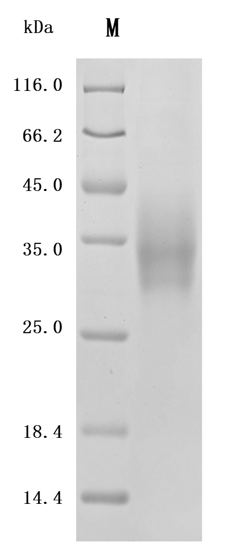 Recombinant Human Leukocyte surface antigen CD47 (CD47), partial (Active), Homo sapiens (Human), Mammalian cell, C-terminal 10xHis-tagged, 15.1 kDa