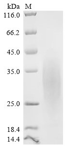 Recombinant Rat Glucagon-like peptide 1 receptor (Glp1r), patial (Active), Rattus norvegicus (Rat), Mammalian cell, C-terminal 10xHis-tagged, 14.9 kDa, purity >90% as determined by SDS-PAGE.