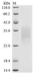 Recombinant Mouse Glucagon-like peptide 1 receptor (Glp1r), partial (Active), Mus musculus (Mouse), Mammalian cell, C-terminal 10xHis-tagged, 15.8 kDa, purity >90% as determined by SDS-PAGE.