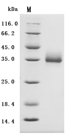 Recombinant Human T-cell surface antigen CD2 (CD2), partial (Active), Homo sapiens (Human), Mammalian cell, C-terminal 10xHis-tagged, 22.7 kDa, purity >95% as determined by SDS-PAGE.Greater than 95% as determined by SEC-HPLC.