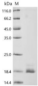 Recombinant Human Tumor necrosis factor receptor superfamily member 10B (TNFRSF10B), partial (Active), Homo sapiens (Human), Mammalian cell, C-terminal 10xHis-tagged, 15.7 kDa, purity >95% as determined by SDS-PAGE.