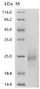 Recombinant Human Macrophage colony-stimulating factor 1 (CSF1), partial (Active), Homo sapiens (Human), Mammalian cell, N-terminal 10xHis-tagged, 21.2 kDa, purity >95% as determined by SDS-PAGE.