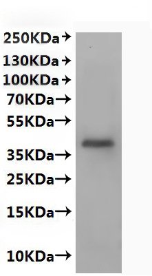 Recombinant Human C-X-C chemokine receptor type 2 (CXCR2)-VLPs (Active), Homo sapiens (Human), Mammalian cell, C-terminal 10xHis-tagged, 42.2 kDa, purity >VLPs