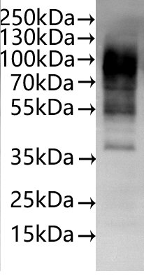 Recombinant Human Apelin receptor (APLNR)-VLPs (Active), Homo sapiens (Human), Mammalian cell, C-terminal 10xHis-tagged, 44.1 kDa, purity >/
